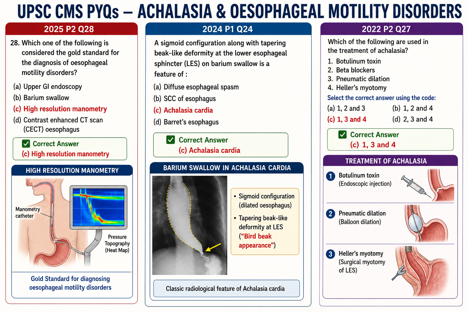 Achalsia cardia Q